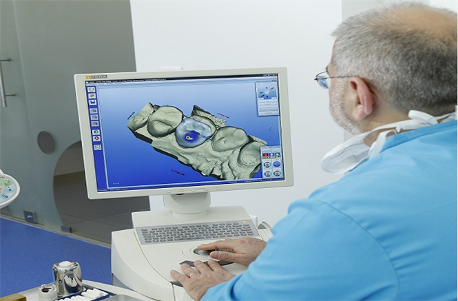 Cerec crown or inlay IN JUST ONE SINGLE VISIT