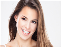 Orthodontic treatment for adults