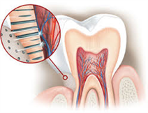 Endodontic Therapy